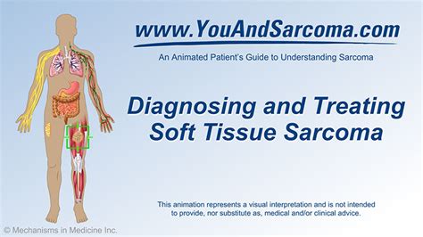 which diagnostic test is used for detecting soft-tissue lesions|Soft Tissue Sarcoma: Symptoms, Treatment & Prognosis.